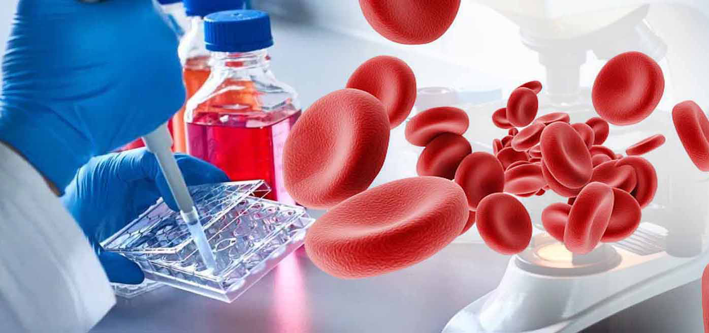 Гематология